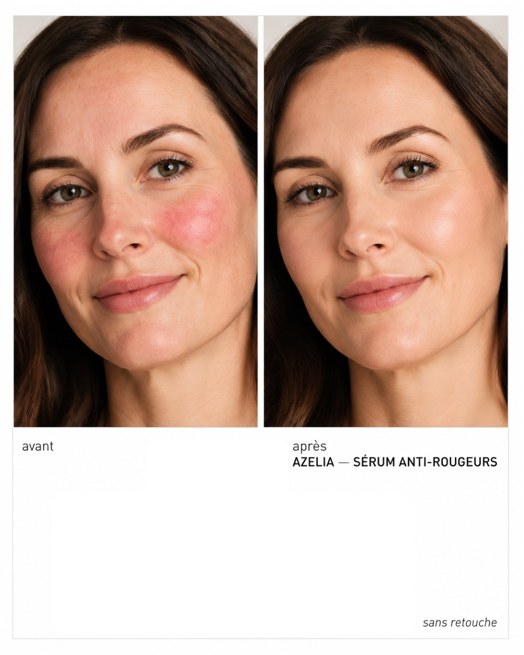 Sérum anti-rougeurs Azélia